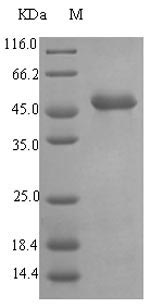 Recombinant Pseudolysin (EC 3.4.24.26, Pseudomonas elastase, Pseudomonas aeruginosa neutral metalloproteinase),  E.coli, 1 mg