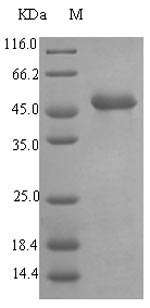 [0399-CSB-EP318584EZX-1MG] Recombinant Pseudolysin (EC 3.4.24.26, Pseudomonas elastase, Pseudomonas aeruginosa neutral metalloproteinase),  E.coli, 1 mg