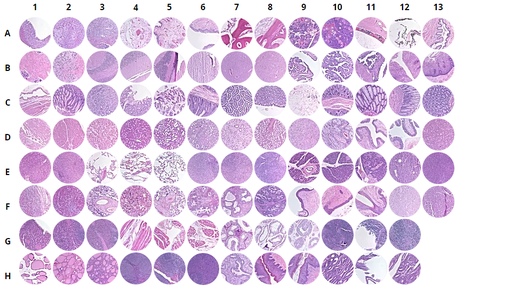 [0313-MNO1021] Normal human tissues, FDA, 35 organs in triplicates (1.5 mm) - 8 Row/13 Column